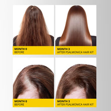 Load image into Gallery viewer, Hair Growth Shampoo and Conditioner Set: Sulfate Free Hair Growth Root Activator Thickening Shampoo for Hair Loss and Thinning Hair - Hair Loss RegrowthTreatments for Women Men