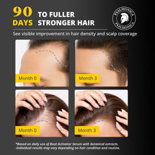 Load image into Gallery viewer, Hair Growth Serum: Root Activator Scalp Treatment for Hair Loss &amp; Regrowth with Rosemary Oil - Botanical DHT Blocker Hair Thickening Formula for Thinning Hair - for Women &amp; Men (1 Fl Oz (Pack of 1))