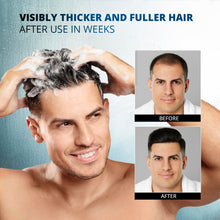 Load image into Gallery viewer, Root Activator Shampoo for Men: Hair Growth Shampoo for Hair Loss and Thinning Hair - Hair Loss Regrowth Shampoo for Men Women (Refreshing Scent)